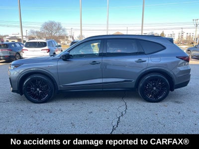 2025 Acura MDX A-Spec Advance Package SH-AWD